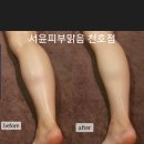 피부맑음