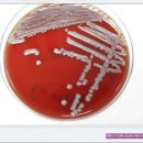 Klebsiella pneumoniae ssp pneumoniae(BAP & MAC & SS)의 성상 이미지