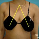 에스에이치의원 | 가슴 지방이식 후기에서 가장 만족도가 높았던 변화, 처진 가슴 리프팅효과