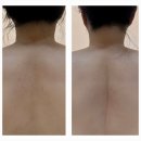 비디알(bdr) | 천안림프관리 불당동 비디알 bdr 목 어깨 두피 림프바디 순환 관리 후기
