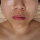 박지인 피부관리