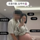 초아 카카오 검색결과
