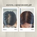 에스포피 | [탈모 샴푸] 비오티아 스칼포필 탈모완화 샴푸 사용 후기