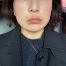 삼성동-3 | 삼성동피부과 | 듀얼티타늄리프팅3차 내돈내산 만족하는 후기!