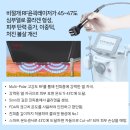 NEW 청우에너지 | 에어젯 인모드 리프팅 인어젯 효과 후기 비용 피부탄력시술 성신여대 한성대역피부과 PHD피부과...