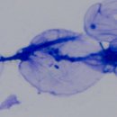 헬릭스동물심장수술센터 | 1) [오리진동물피부과병원, 양산에스동물암센터] 악성비만세포종 확진 상담