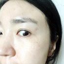 청담포레의원 | 내손동 피부과 추천 벨포레 청담포레의원