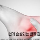 풋사랑정형외과의원 이미지