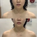 미래미인 | 숨은 얼굴라인 발굴해주는 청주윤곽관리 후광미인 뱀부윤곽관리 후기