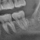 물금센트럴치과의원 이미지