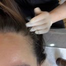 메디포올 이미지