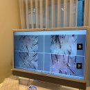 6889 | 20대 여자 탈모 새치 흰머리 두피 관리 스케일링 솔직후기 WT메소드 강서 마곡점