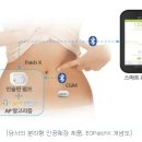비앤케이메드(B&K MED) | 이오플로우 - 슈퍼개미 김정환의 미꾸라지 게임