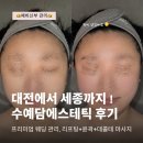수예 | [신부관리] 세종웨딩관리로 유명한, 리프팅+윤곽+데콜테 "수예담에스테틱" 후기