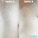 동양제모 이미지