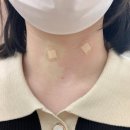 박정수연세의원 | [연세온유외과의원 / 일산 차병원 / 김희준 교수님 / 갑상선 유두암] ① 추적검사와 입원 전 진료 및 검사