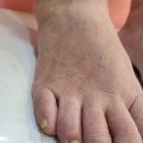 제시뷰티포항1호점 메이크윤 | 파고드는발톱 아프게 놔두지마시고 제시뷰티 메이크윤 포항1호점에서 해결해보세요!