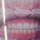 진심을 담은 치과교정과 치과의원 이미지