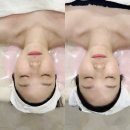 송파24약국 | 송파 피부관리 프라이빗한 쁘에르에스테틱 홍조 건성 수분케어