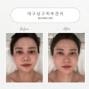 풀로채에스테틱 | 대구남구피부관리 풀로채에스테틱 유경오름테라피 후기