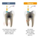 엔도위즈 이미지
