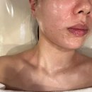 [철산동윤곽관리] 수뷰티센터광명점 더더올리지오리프팅+V윤곽관리 받은후기