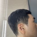 코스모플로 | [흑자치료완료]이상욱 원장님 신뢰 하나로 시작한 닥터 코스모 화장품 솔직 후기