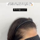 도트인스칼프 이미지