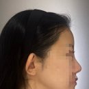 멍발머리 이미지