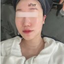 화봉시장 | 올가드림뷰티 화봉점 수분 채워주는 울산물광관리 후기