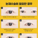 고려피알 이미지