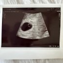 맘존 여성병원 이미지