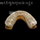 베스트 얼라인 치과기공소 이미지