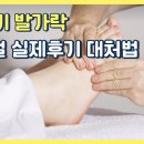 [건강일기] 새끼 발가락 골절, 두 달간의 깁스 치료 후기 – 사소한 사고가 남긴 큰 교훈