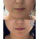 [평택 스무살에머물다 평택비전점] 뉴스킨 갈바닉으로 받은 수분리프팅관리 후기