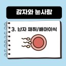 메디텍스 | [시험관 #3] 감눈 시험관 난자 채취 후 이식 준비 과정