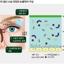 디쿠아포솔 vs 레바미피드 이미지