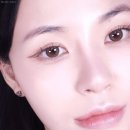 600 | 왕십리 피부과 덴서티 하이 600샷 후기! 통증 리프팅 효과 정리