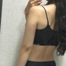 세계로팔등로점 | [시술후기]예신관리로 강남역 피부과에서 받아본 팔뚝 인모드+코어스컬프 솔직후기