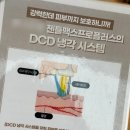 레이저 | 구디피부과 여자 얼굴 레이저제모 후기