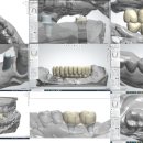 보람치과기공소 이미지