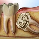 강남사랑니치과의원 이미지