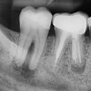 휴플란트치과의원 이미지