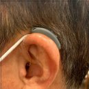 이화보청기 이미지