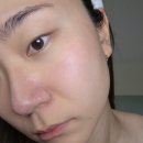 (주)제이에스디유통 | [공지] 시술 후 관리 탄력앰플 추천, 레미디유 스킨부스터 앰플 4주 홈케어 루틴 (feat. 양갱마켓 공구)