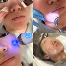 세븐일레븐 대전봉명시티빌점 | 대전 유성 피부관리 봉명동 화답뷰티에서 좁쌀여드름 케어 받고 온 후기