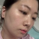 이혈 테라피 | WBL 연예인귀침 이혈테라피 사용 후기