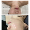 남양주피부관리] 글루타치온 미백관리:: 더블제이뷰티 방문후기