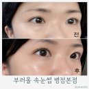 블랙핏 | 병점속눈썹 추천! 블랙핏펌 후기, 눈썹왁싱 가능한 부러올 속눈썹