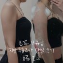 (주)라인쿡 | 안산 팔뚝, 부유방 지방추출주사 당일 후기 통증, 전후 후기